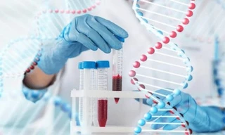 Ung thư thận gia tăng: Những dấu hiệu âm thầm dễ bị bỏ qua