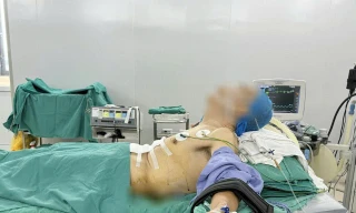 Phẫu thuật ung thư dạ dày cho bệnh nhân trong tư thế hiếm gặp