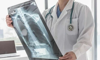 Ung thư phổi không còn là án tử: Vũ khí từ liệu pháp trúng đích và cá thể hóa