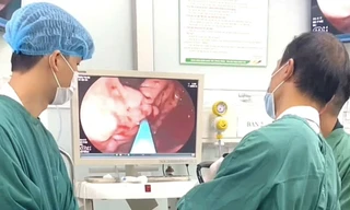 Xuất huyết tiêu hóa: Biến chứng nguy hiểm có thể khởi phát đột ngột, đe dọa tính mạng