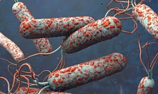 Dịch tả bùng phát tại nhiều quốc gia, Việt Nam siết chặt giám sát