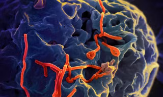 Dịch Ebola diễn biến phức tạp, Bộ Y tế họp khẩn
