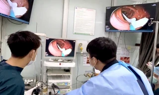 Sán dây dài gần 1 mét sống trong đại tràng người đàn ông có thói quen ăn đồ tái