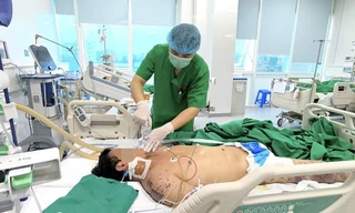 Nguy kịch vì vi khuẩn não mô cầu: Dễ nhầm lẫn với liên cầu khuẩn lợn