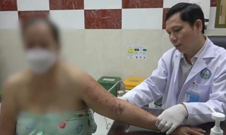 Zona thần kinh tiềm ẩn nhiều biến chứng nghiêm trọng