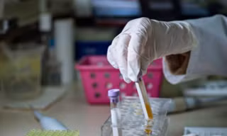 Tưởng rối loạn tiền đình, người phụ nữ mắc viêm màng não do nấm 