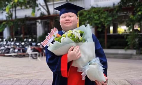 Nghị lực của chàng trai bạch tạng tốt nghiệp loại Giỏi ngành Sư phạm Toán 