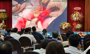 Truyền hình trực tiếp phẫu thuật phục hồi 'bản lĩnh đàn ông'