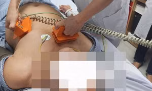 Nam thanh niên gục trên bàn, ngưng tim vì mối nguy tiềm ẩn trong mọi gia đình