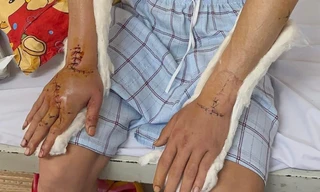 Tin mới vụ nhóm đối tượng đuổi chém, cướp tài sản của người đang về quê ăn Tết