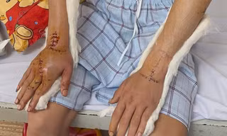 Tin mới vụ nhóm đối tượng đuổi chém, cướp tài sản của người đang về quê ăn Tết