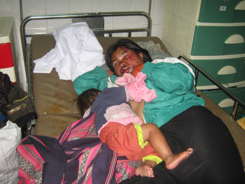 Lật xe công nông, 35 người nhập viện