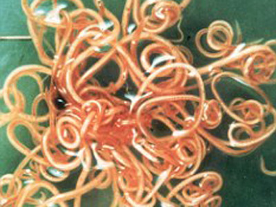 Ăn trứng giun để giảm cân