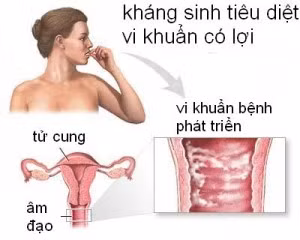 Viêm âm đạo kéo dài gây ung thư?