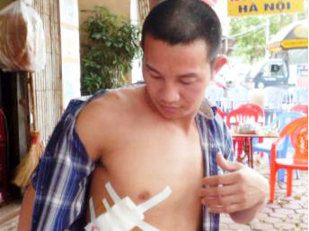 Một nghi can vụ xả súng truy sát chủ quán bia bị bắt