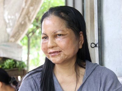 'Nữ sinh hóa bà lão' ở Hội An: Sức khỏe giảm sút