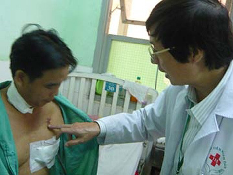 Cứu sống thanh niên nhậu say bị đâm trúng tim