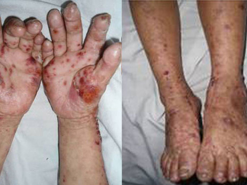 Bệnh ‘lạ’ không chỉ ở Quảng Ngãi