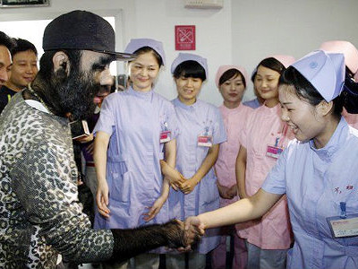 Chàng trai rậm lông muốn có vợ