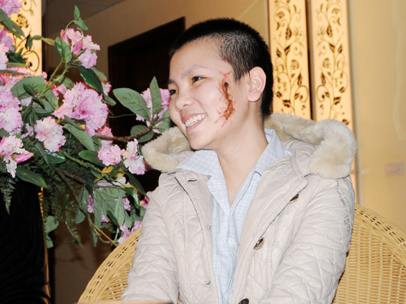 Cô gái bị xăm rết lên mặt muốn làm việc ở bệnh viện