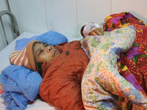 Bạn đọc phẫn nộ vì Osin bị bạo hành dã man