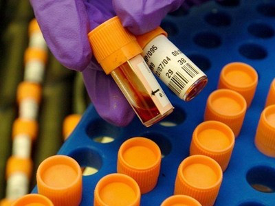 Nghiên cứu về thuốc chống HIV là đột phá của năm