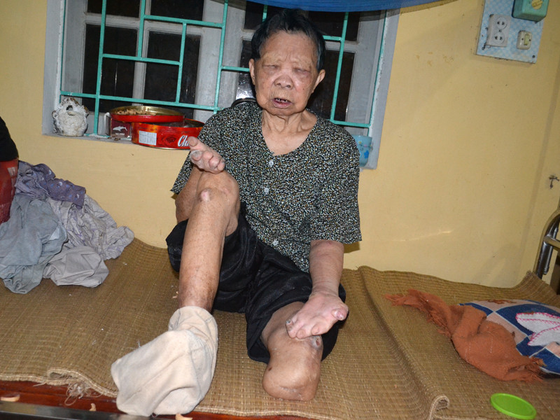 Cụ Vũ Thị Bớt đau khổ vì không thể tự sinh hoạt nay lại bị bỏ đói