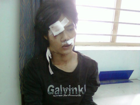 Bắt khẩn cấp tên cướp cuồng sát trên phố