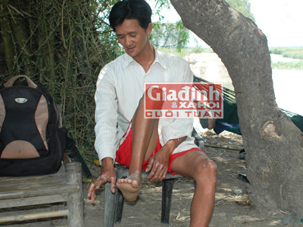 Lạ kì 'người rắn' ở miền Tây