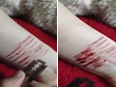 Thiếu nữ thất tình rạch tay làm ...kỷ niệm