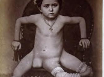 Chuyện tình cặp đôi cùng có 2 bộ phận sinh dục