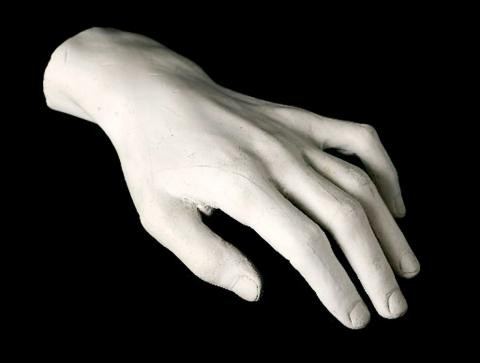 Phục hồi dị tật tay bằng vi phẫu