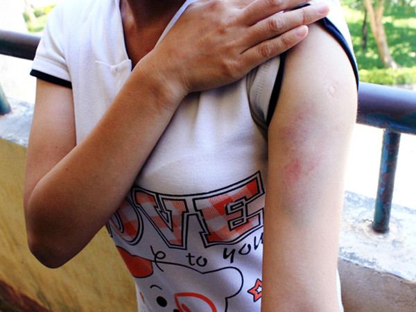 Nữ sinh sư phạm đánh bạn nhập viện