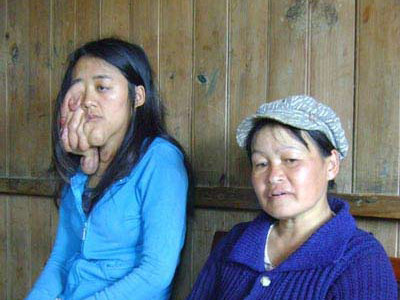 Hai phụ nữ trẻ mắc bệnh “lạ”