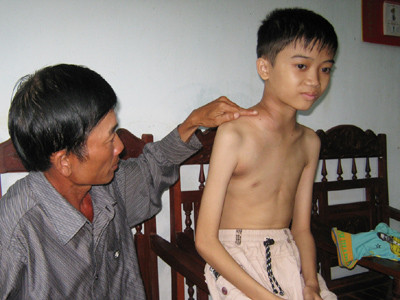 Học sinh bị bệnh hiểm nghèo cần giúp đỡ