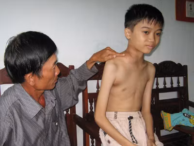 Học sinh bị bệnh hiểm nghèo cần giúp đỡ