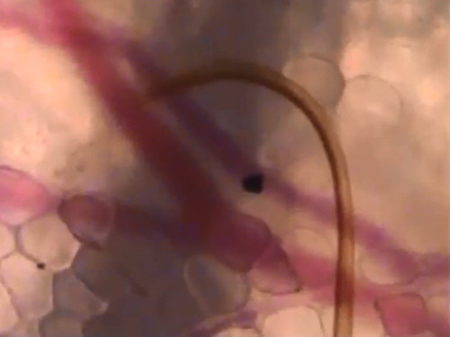 Rợn người cảnh muỗi huơ vòi hút máu dưới da