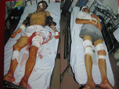 Cha con ông Tiến điều trị tại Bệnh viện 115 Nghệ An