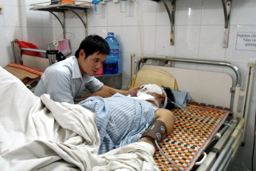 Nạn nhân kể lại khoan trúng điện, bị cháy sém