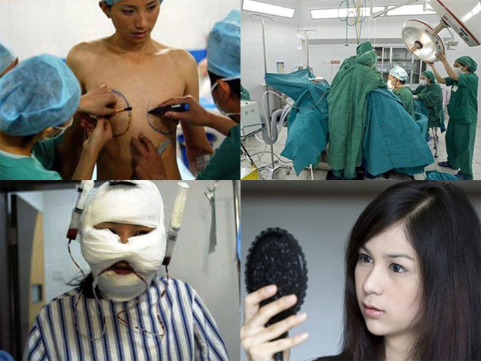 'Giá đắt' cho việc chuyển giới nam thành nữ