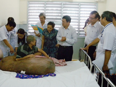 Rất khó phẫu thuật cho người mang khối u 80kg