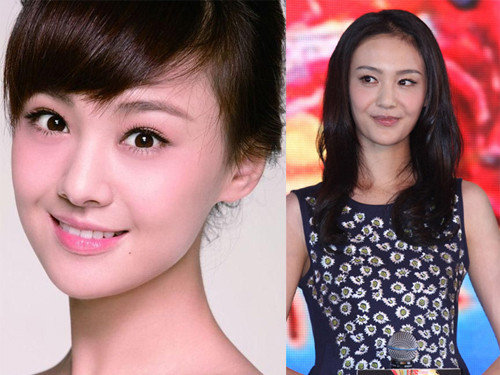 Những sao châu Á xấu đi vì phẫu thuật thẩm mỹ