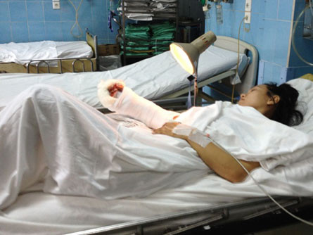 Cô gái đi xe SH bị cướp chém gần lìa tay