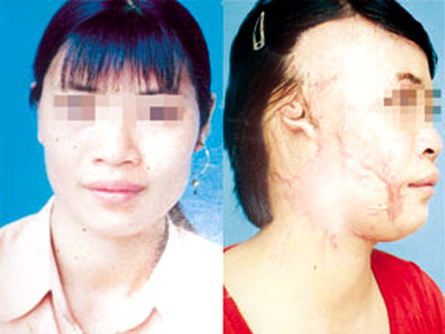 Tạt axít người dưng vì nghe 'thầy' phán