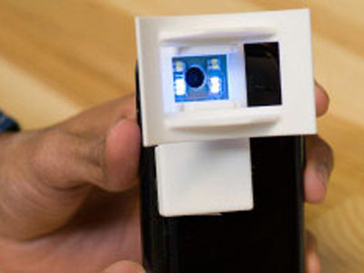 Chẩn đoán ung thư miệng bằng điện thoại