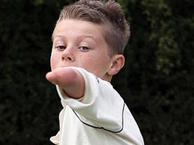 Cậu bé cụt tay thành ngôi sao bóng chày