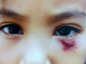 GV đánh học sinh, trường mầm non bị đóng cửa