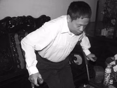 Giã từ nạng sau 15 năm bị gout
