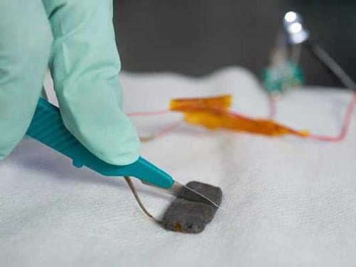 Da tự lành cấp tốc