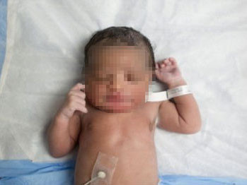 Bé gái 10 tuổi sinh con